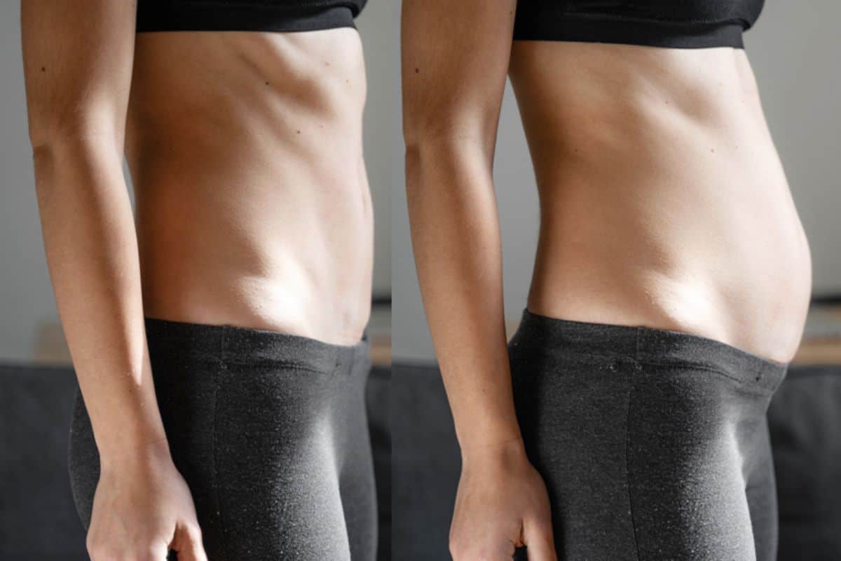 How long does diastasis recti take to improve Hounslow Heath?
