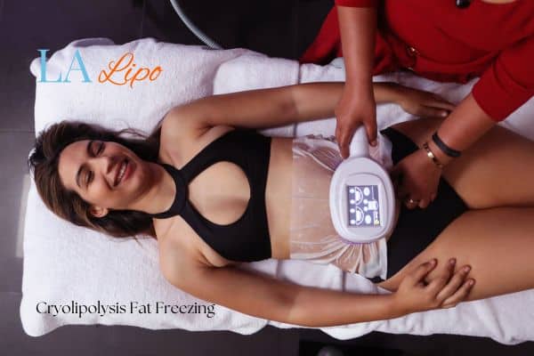 woman getting cryolipolysis Hounslow Heath