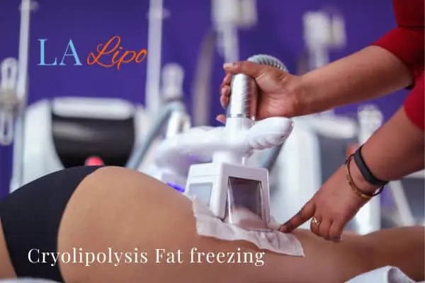 women getting fat freezing Hounslow Heath