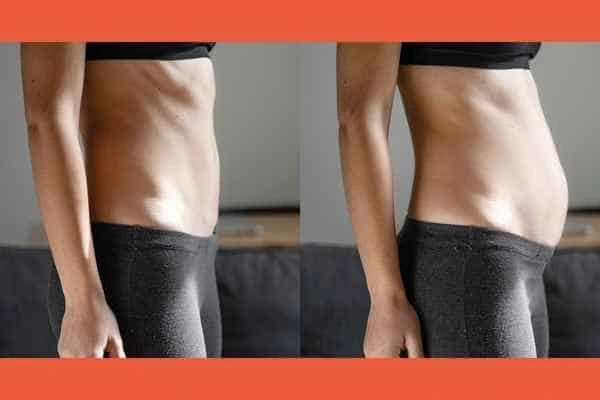 LA-EMS Body Sculpting results Hounslow Heath