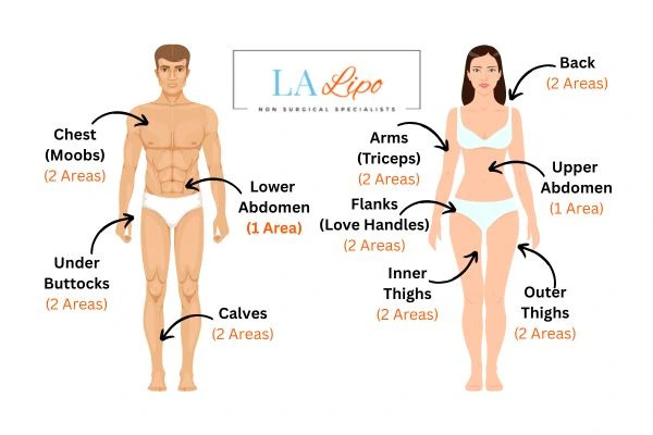 LA LIPO Cryolipolysis Areas Hounslow Heath