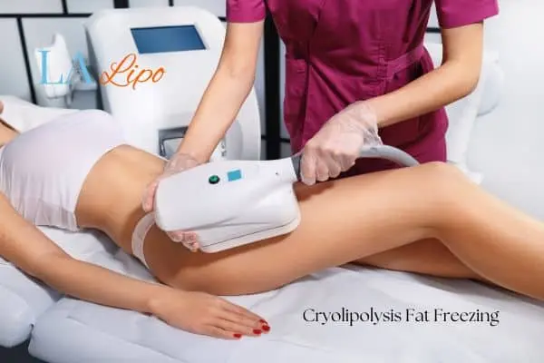 Woman receiving coolsculpting Hounslow Heath treatment on her thighs