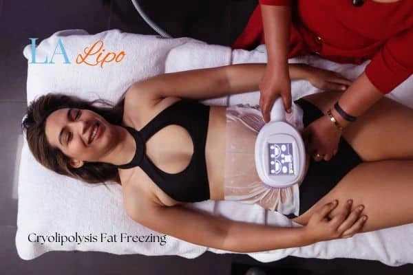 woman getting cryolipolysis Hounslow Heath