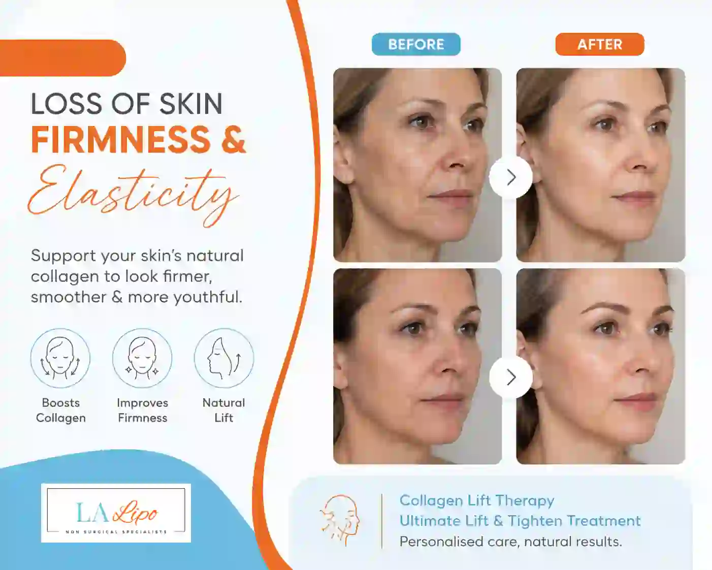 Sign #7: Loss of Skin Firmness and Elasticity Hounslow Heath